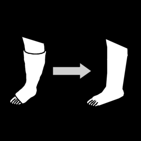 broken leg